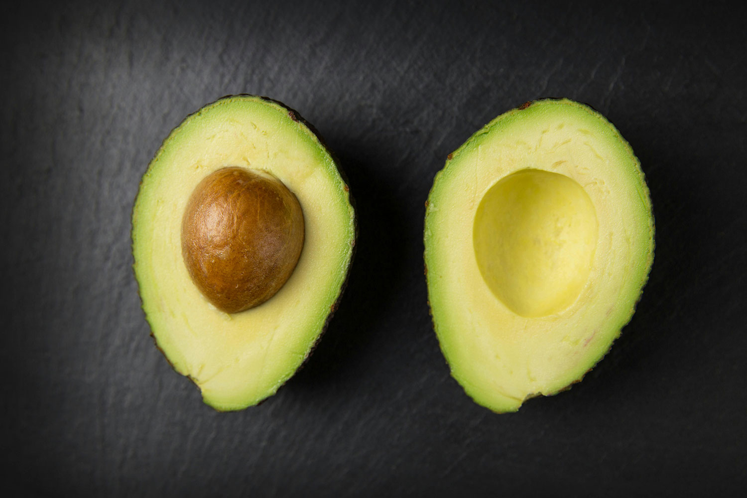 Avocado Fats - Slided Avocado